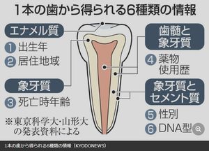 歯1本から身元6情報取得　災害犠牲者の特定期